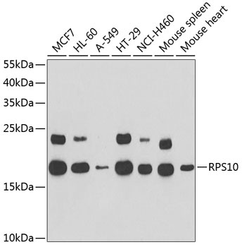 RPS10 Antibody