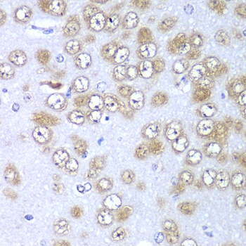 RPS10 Antibody