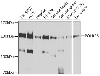 POLR2B Antibody