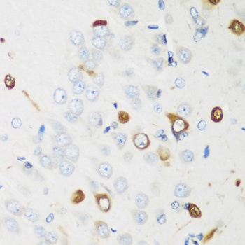 ELAVL2 Antibody