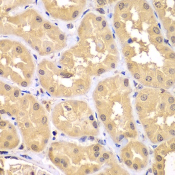 TRIM69 Antibody