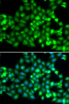 TRIM69 Antibody