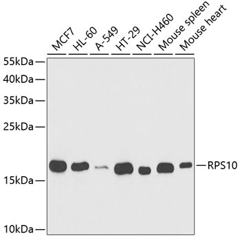 RPS10 Antibody