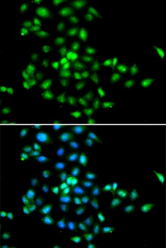 SBDS Antibody