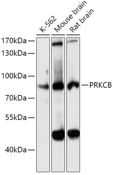 PRKCB Antibody
