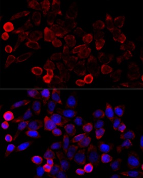 KAT7 Antibody