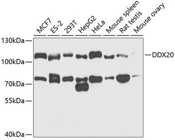 DDX20 Antibody