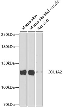 COL1A2 Antibody