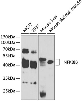 NFKBIB Antibody