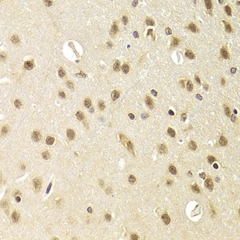 HEXIM1 Antibody