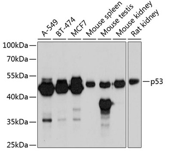 p53 Antibody