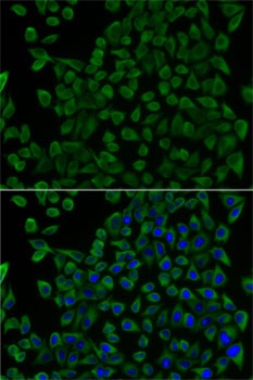 TCN2 Antibody