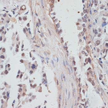 NCOA4 Antibody