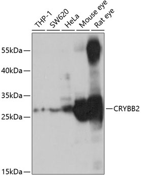 CRYBB2 Antibody