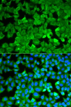 ASNS Antibody