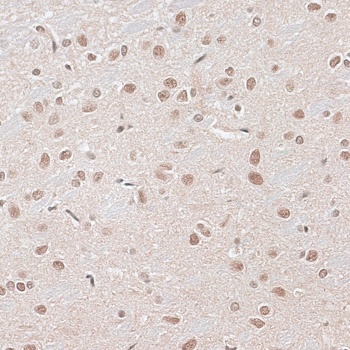 CBX6 Antibody