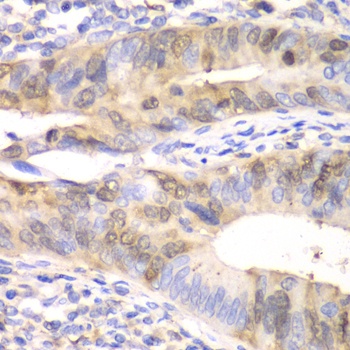 UBE2C Antibody