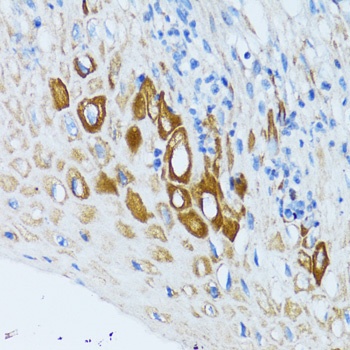 PSRC1 Antibody