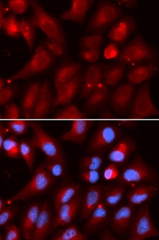 PSMB2 Antibody