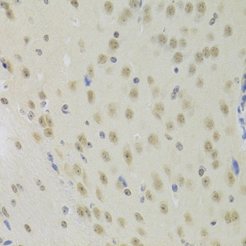 PRPF3 Antibody