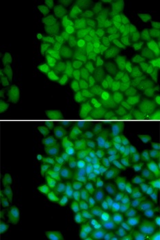 MAGEA1 Antibody