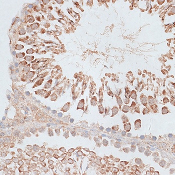 KIF2C Antibody