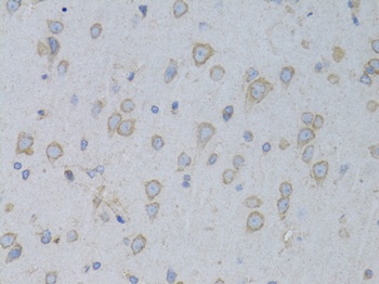 GARS Antibody