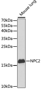 NPC2 Antibody