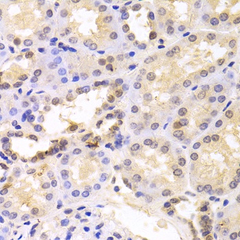PSMC6 Antibody