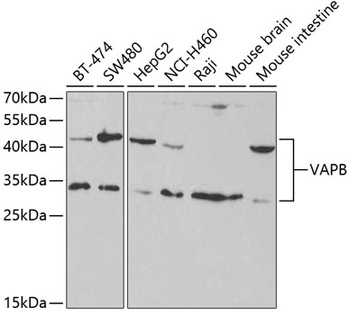 VAPB Antibody