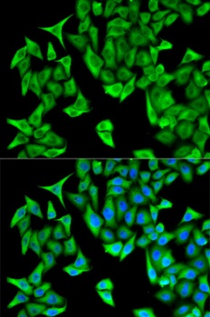 PSMD9 Antibody