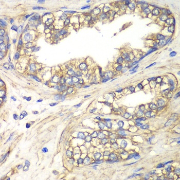 SLC4A4 / NBC Antibody