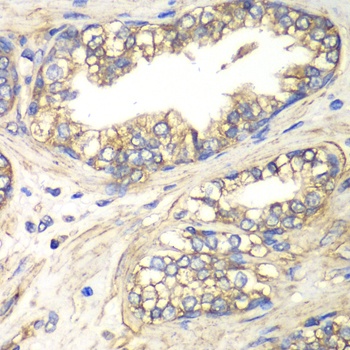 SLC4A4 Antibody