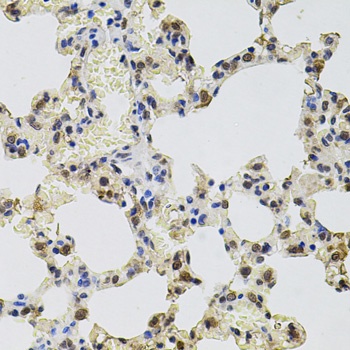 GTF2H2 Antibody