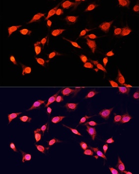 H3K14me3 Antibody