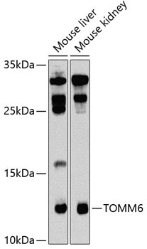 TOMM6 Antibody