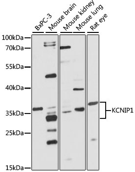 KCNIP1 Antibody