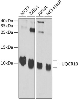 UQCR10 Antibody