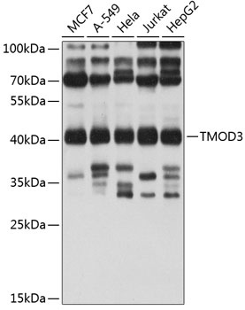 TMOD3 Antibody