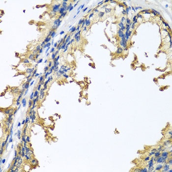 NLGN4Y Antibody