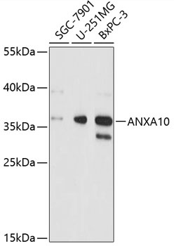 ANXA10 Antibody