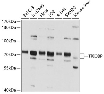 TRIOBP Antibody