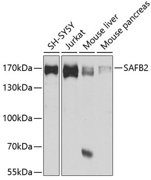 SAFB2 Antibody