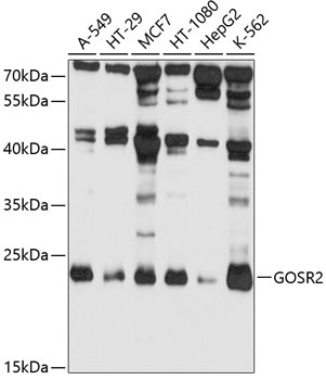 GOSR2 Antibody