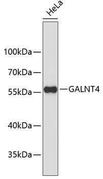 GALNT4 Antibody