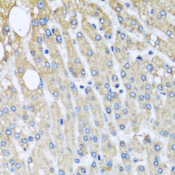 UQCRC2 Antibody