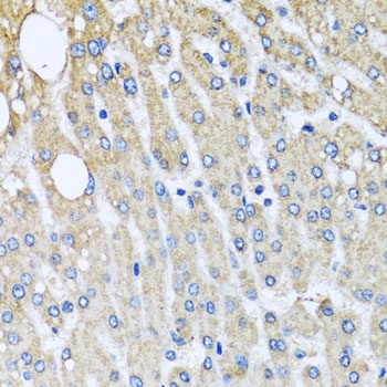 UQCRC2 Antibody