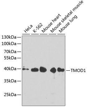 TMOD1 Antibody