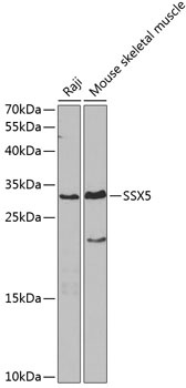 SSX5 Antibody