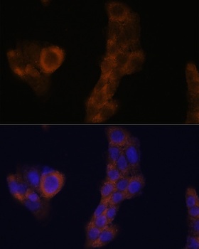 RPL23A Antibody